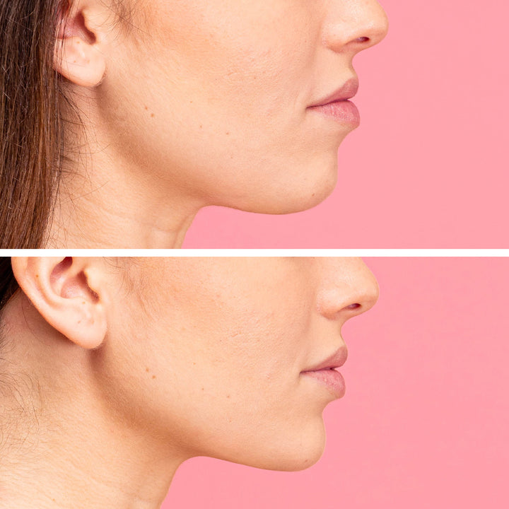 LiftUp - Gel Rassodante e Liftante Mento | Eco Bio Boutique