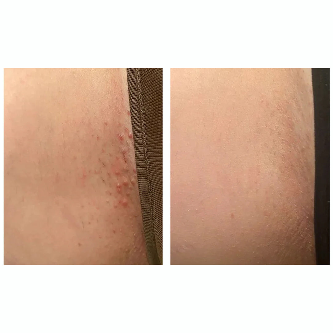 Set Depilazione Perfetta