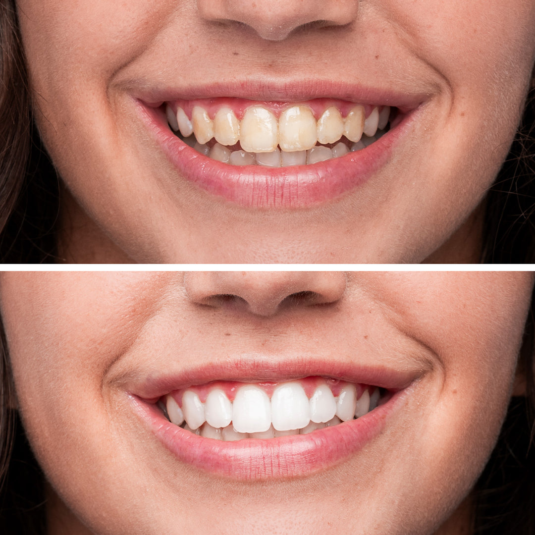 Dentifricio Sbiancante - White Lab Sbiancante, Illuminante e Lenitivo | Eco Bio Boutique