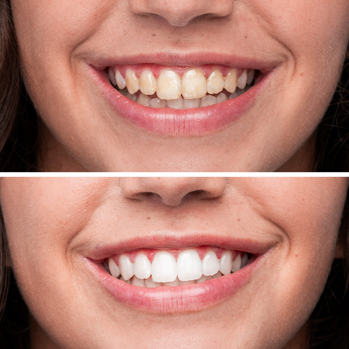 Dentifricio Sbiancante - White Lab Sbiancante, Illuminante e Lenitivo | Eco Bio Boutique