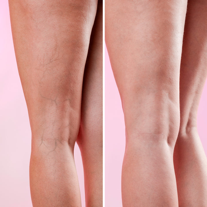 GoLegs - Crema Corpo Defaticante Rivitalizzante | Eco Bio Boutique