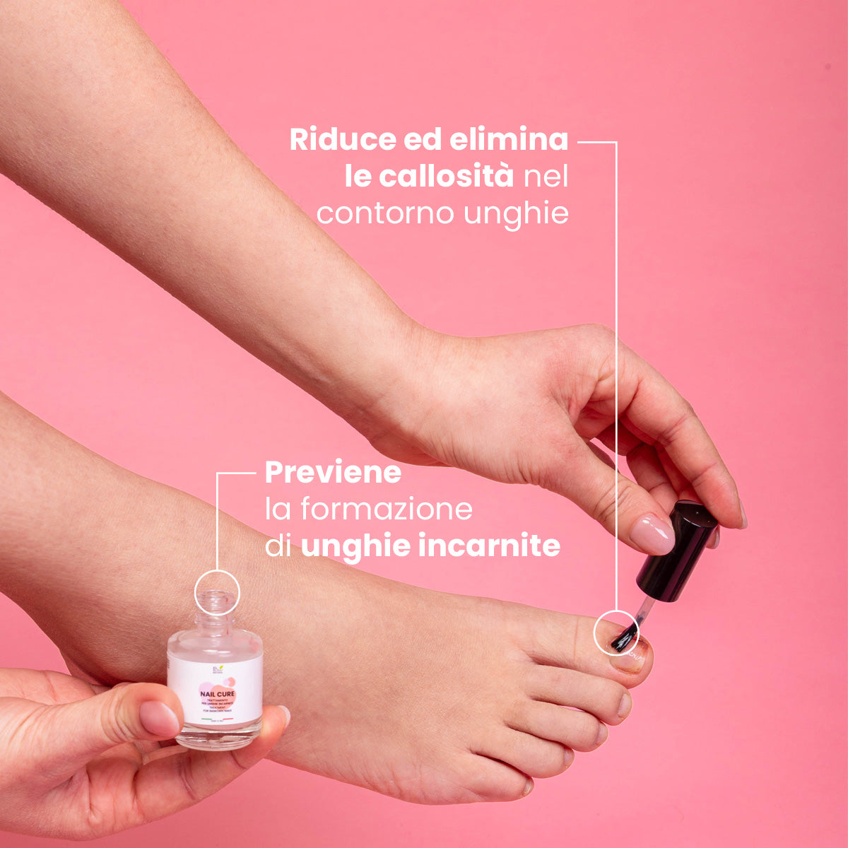 Nail Cure - Trattamento per unghie incarnite | Eco Bio Boutique